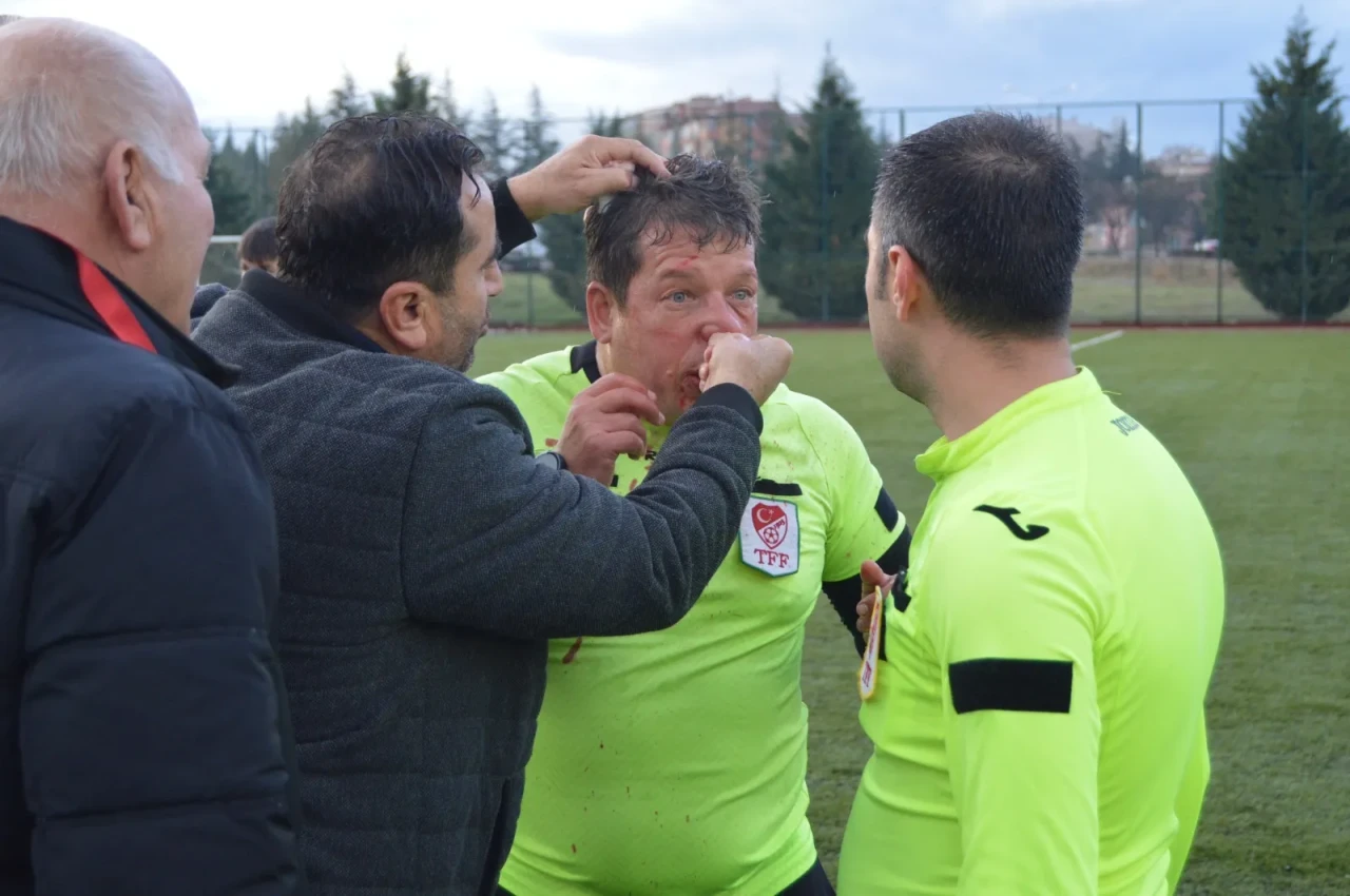 ⚽️ TFFHGD Eskişehir Şubesi'nden Hakem Mesut Eren'e Yapılan Saldırıya Şiddetli Kınama! ​