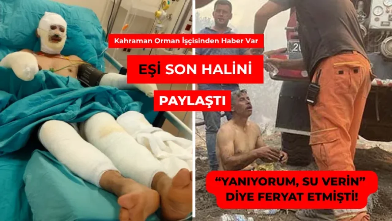 YANIKLARLA MÜCADELE EDİYOR