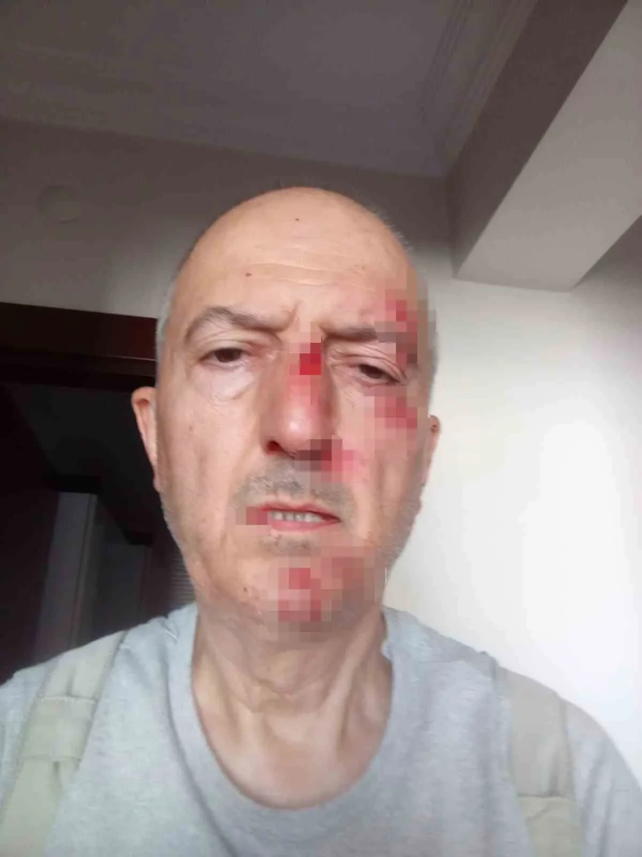 Boşanma Sürecindeki Eşi Evi Satınca Sokakta Kaldı, Darp Edilip Hastanelik Oldu