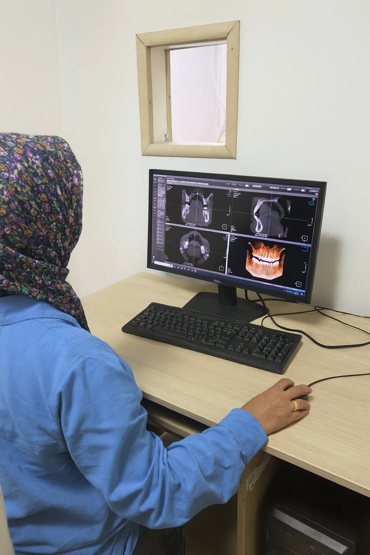 Eskişehirliler Müjde: Diş sağlığında yeni bir dönem başlıyor
