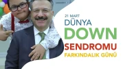 Eskişehir Valisi Aksoy, Down Sendromu Farkındalık Günü mesajı yayımladı