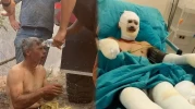 “Yanıyorum, Su Verin” Diye Feryat Eden Orman İşçisinin Son Hali Paylaşıldı