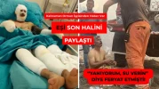 YANIKLARLA MÜCADELE EDİYOR