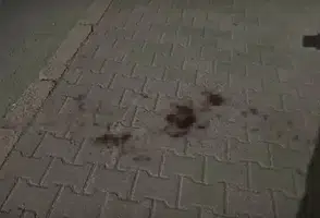 Eskişehir’de bıçaklı kavgada yaralanan genç taburcu edildi