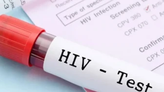 AIDS’e Karşı En Güçlü Silah: Bilgi, Farkındalık ve Erken Teşhis