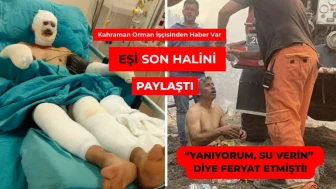 YANIKLARLA MÜCADELE EDİYOR