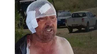 “Ölmekten Kıl Payı Kurtuldum”: Aslan Saldırısına Uğrayan Çiftçi O Anları Anlattı