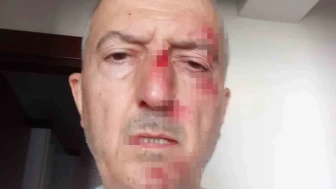 Boşanma Sürecindeki Eşi Evi Satınca Sokakta Kaldı, Darp Edilip Hastanelik Oldu