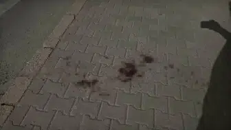 Eskişehir’de bıçaklı kavgada yaralanan genç taburcu edildi