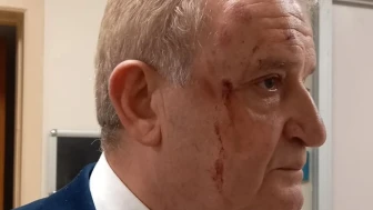 Gazeteci Hakkı Sağlam Saldırıya Uğradı