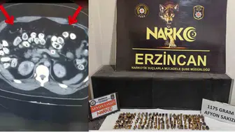 Erzincan'da uyuşturucu kuryeliğinde mide bulandıran yöntem: 287 kapsül vücutlarından çıktı