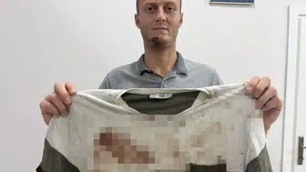 Gürültü uyarısı kanlı bitti: Akrabaları tarafından sopalarla darp edildi