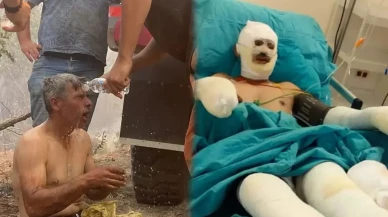 “Yanıyorum, Su Verin” Diye Feryat Eden Orman İşçisinin Son Hali Paylaşıldı
