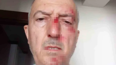Boşanma Sürecindeki Eşi Evi Satınca Sokakta Kaldı, Darp Edilip Hastanelik Oldu