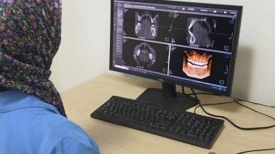 Eskişehirliler Müjde: Diş sağlığında yeni bir dönem başlıyor