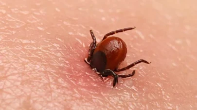 Eskişehir’de kene paniği hastanede bitti