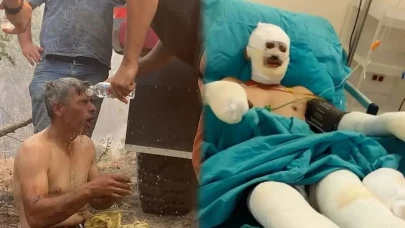 “Yanıyorum, Su Verin” Diye Feryat Eden Orman İşçisinin Son Hali Paylaşıldı