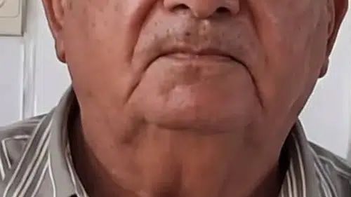 Sarayköy'de park manevrası faciayla bitti: 80 yaşındaki sürücü inşaat temelinde can verdi