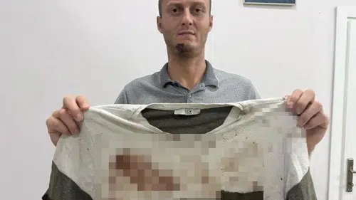 Gürültü uyarısı kanlı bitti: Akrabaları tarafından sopalarla darp edildi