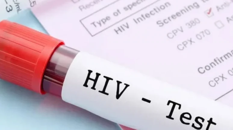 AIDS’e Karşı En Güçlü Silah: Bilgi, Farkındalık ve Erken Teşhis