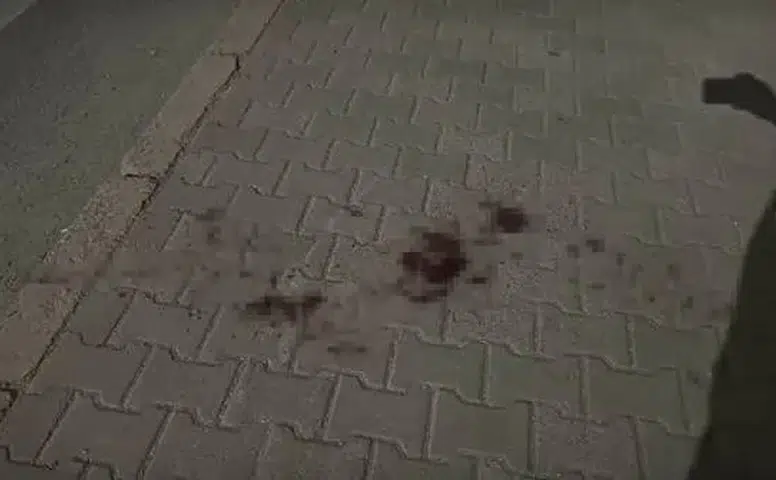 Eskişehir’de bıçaklı kavgada yaralanan genç taburcu edildi