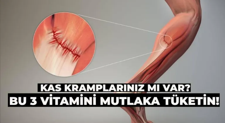 Kas Kramplarınız mı Var? Bu 3 Vitamin Kasılmaların Temel Sebebi, Mutlaka Tüketin!