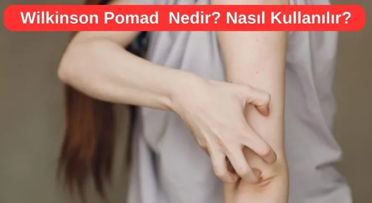 Uyuz Kremi Wilkinson Pomad Nedir? Ne İşe Yarar?