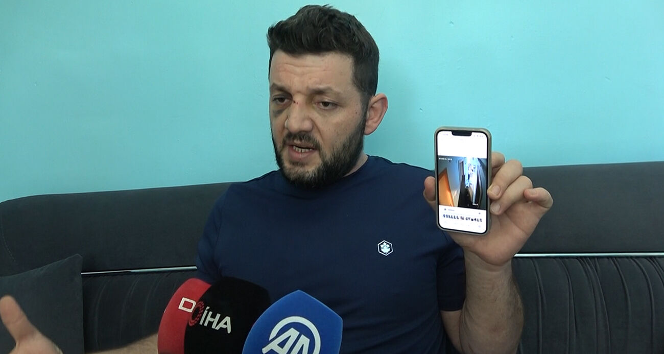 Baba Ve 14 Aylık Bebeğin Yaralandığı Olayda Yeni Gelişme