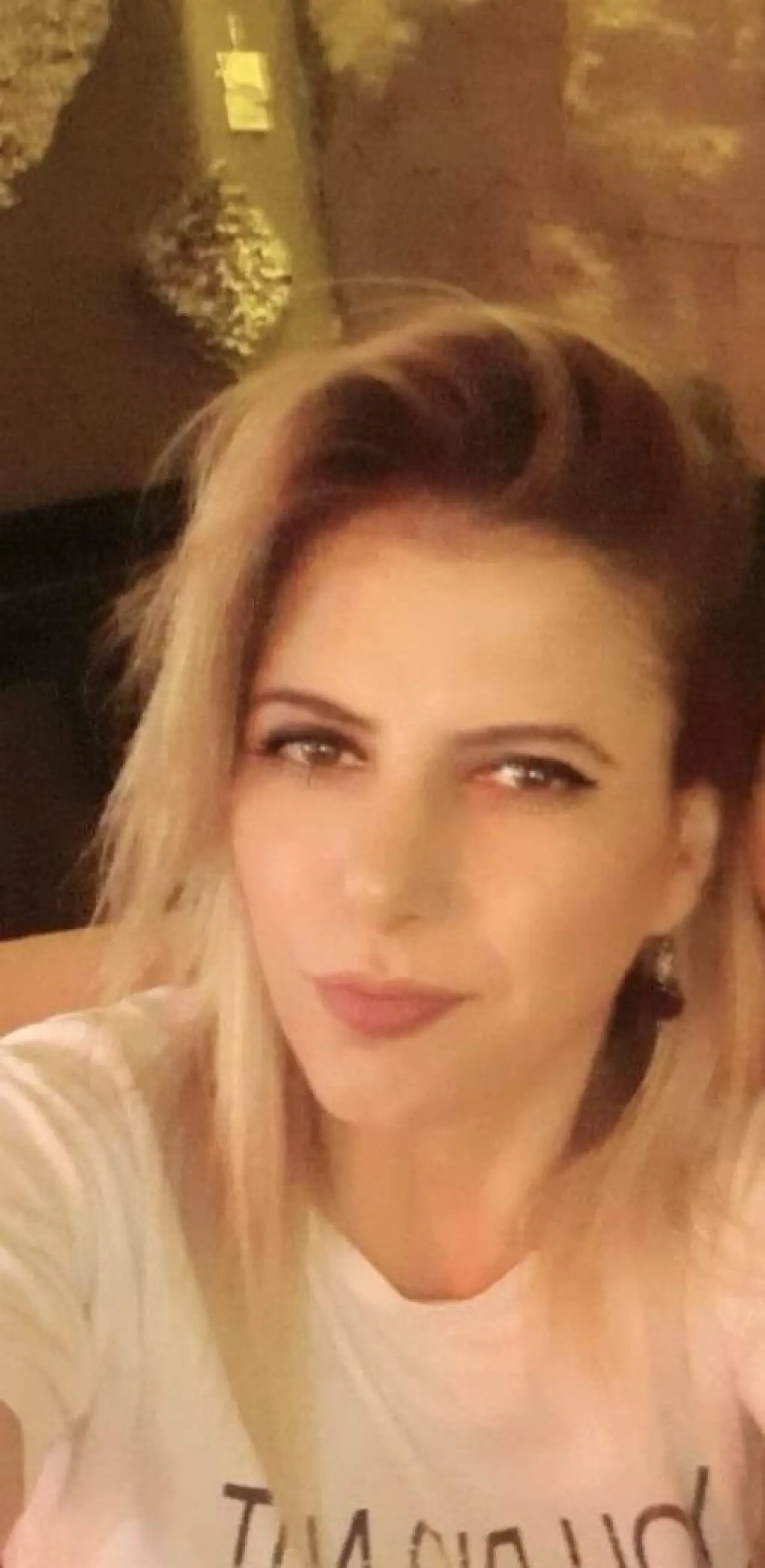 genc-kadinin-hayati-kezzapla-karardi